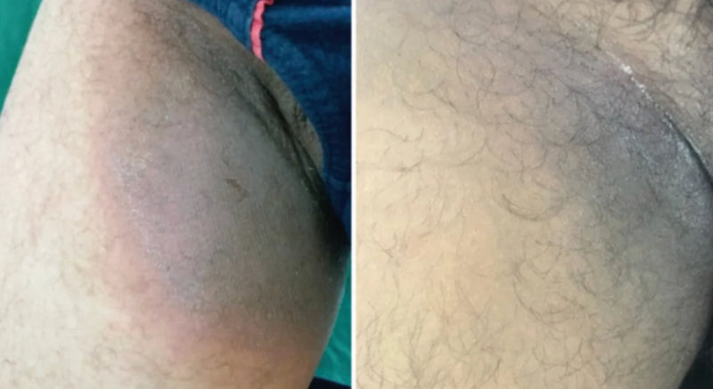 "I can finally sweat without the panic"